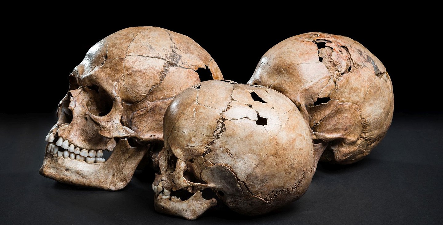 Middle Stone Age (ca. 7700 BC) skull burial from Hohlenstein-Stadel cave, probably family (male, female, hydrocephalic child)