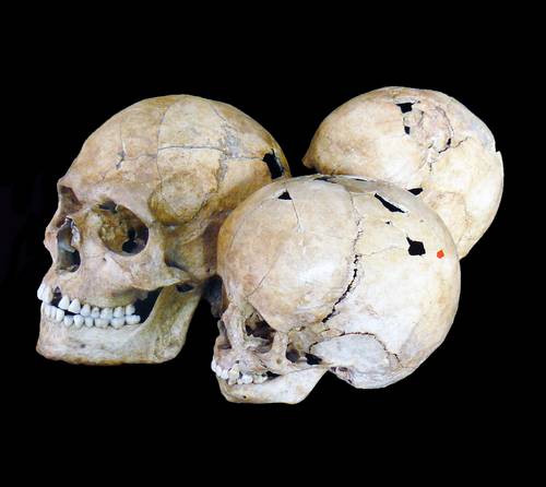 Osteologische Sammlung